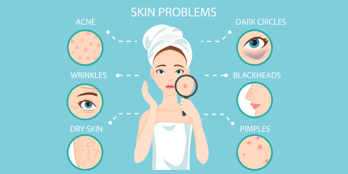 Why Do I Have So Many Skin Problems – SKYA