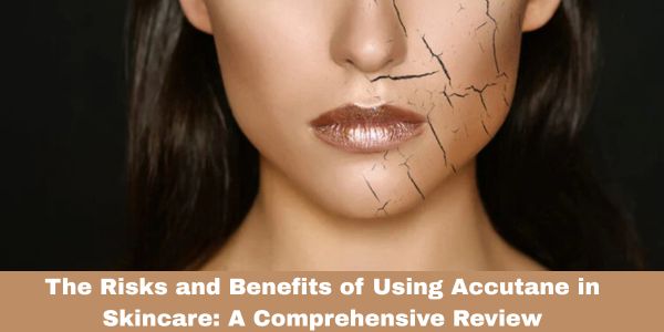 The Risks and Benefits of Using Accutane in Skincare: A Comprehensive Review